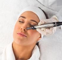 Dermapen